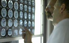Como Realizar Exames de Ressonância Magnética? Aplicação em Neurorradiologia